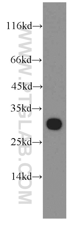 WB analysis of HeLa using 11305-1-AP