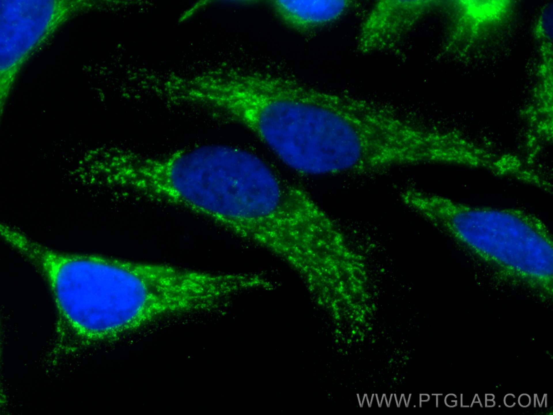 Immunofluorescence (IF) / fluorescent staining of HeLa cells using ECHS1 Monoclonal antibody (66117-1-Ig)
