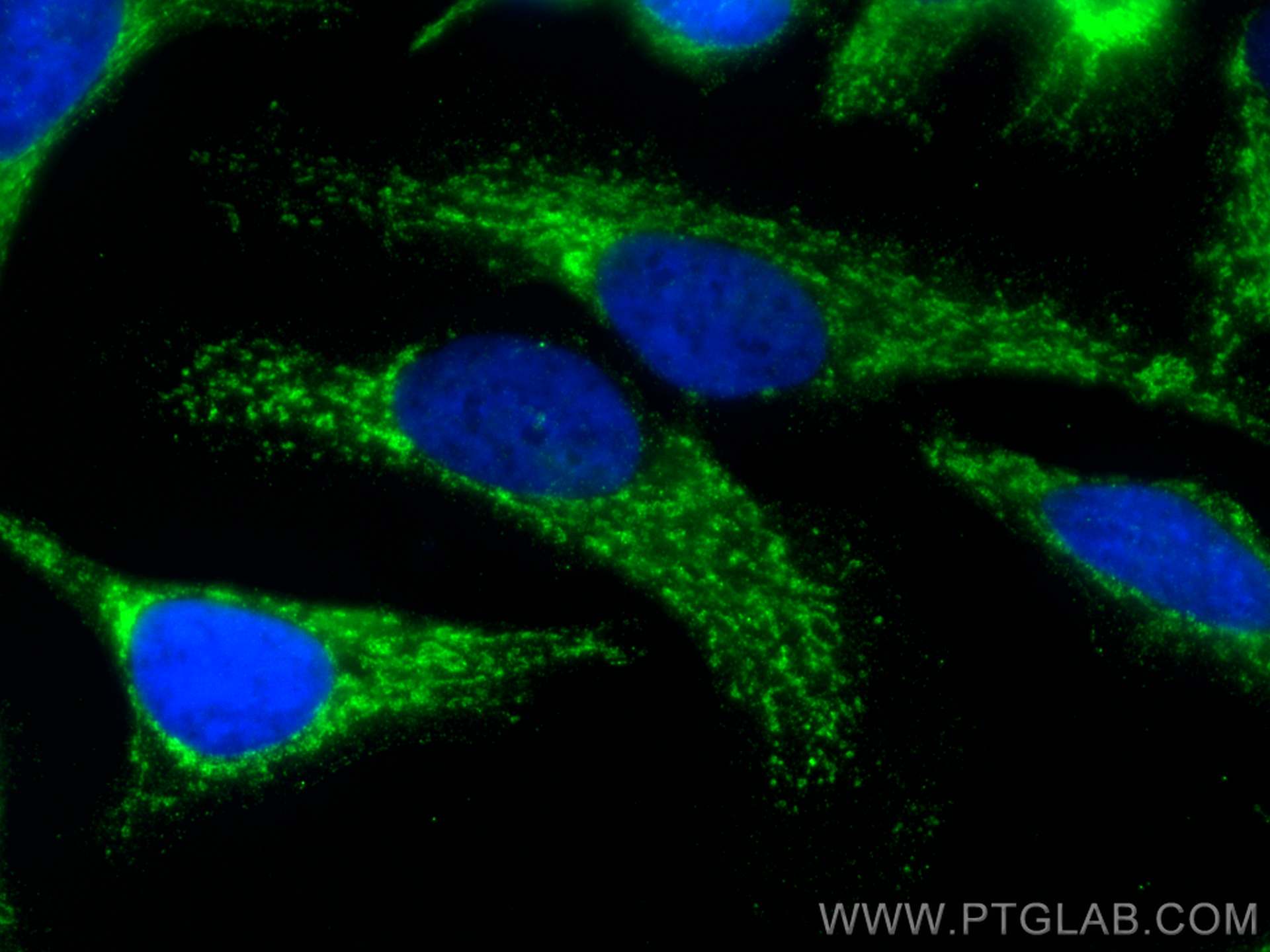 IF Staining of HeLa using 66117-1-Ig