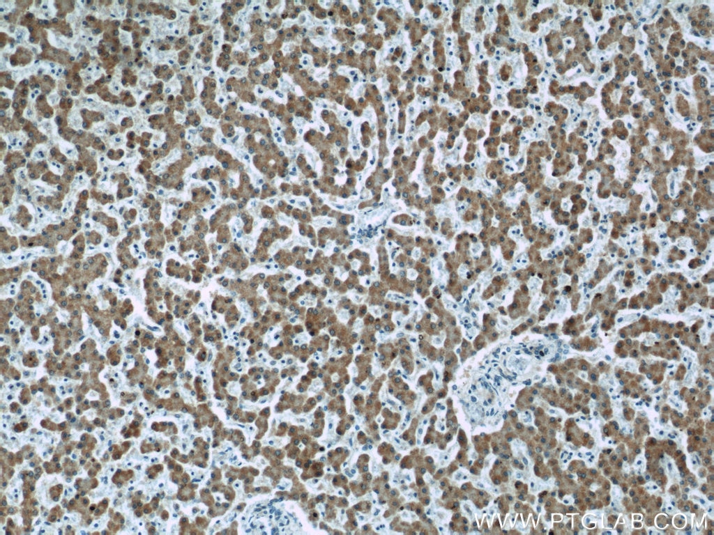 Immunohistochemistry (IHC) staining of human liver tissue using ECHS1 Monoclonal antibody (66117-1-Ig)