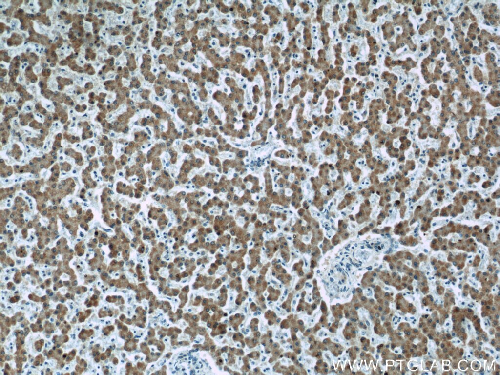 IHC staining of human liver using 66117-1-Ig