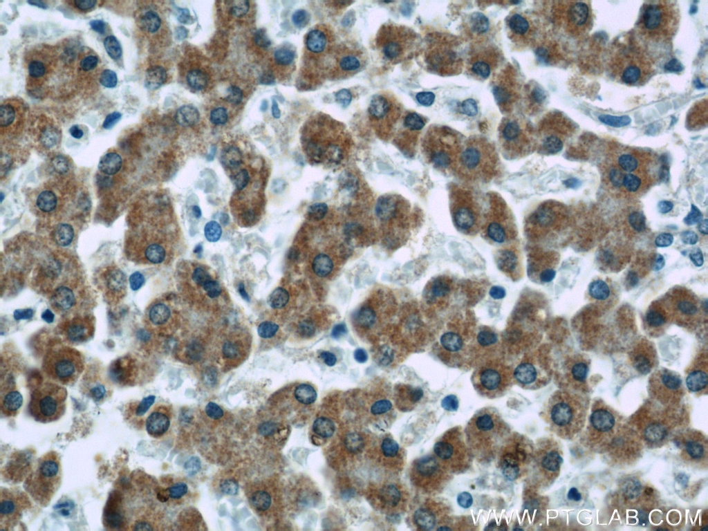 Immunohistochemistry (IHC) staining of human liver tissue using ECHS1 Monoclonal antibody (66117-1-Ig)