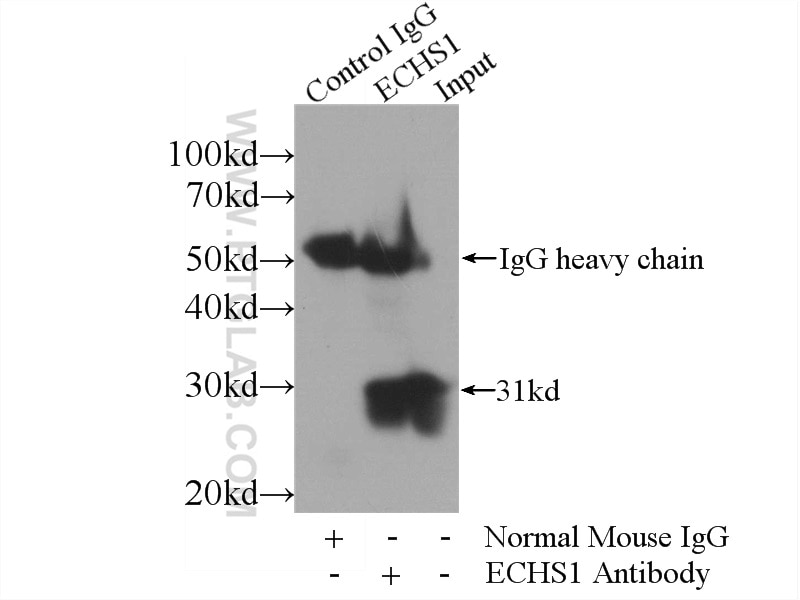 Immunoprecipitation (IP) experiment of HepG2 cells using ECHS1 Monoclonal antibody (66117-1-Ig)