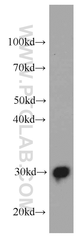 Western Blot (WB) analysis of human testis tissue using ECHS1 Monoclonal antibody (66117-1-Ig)