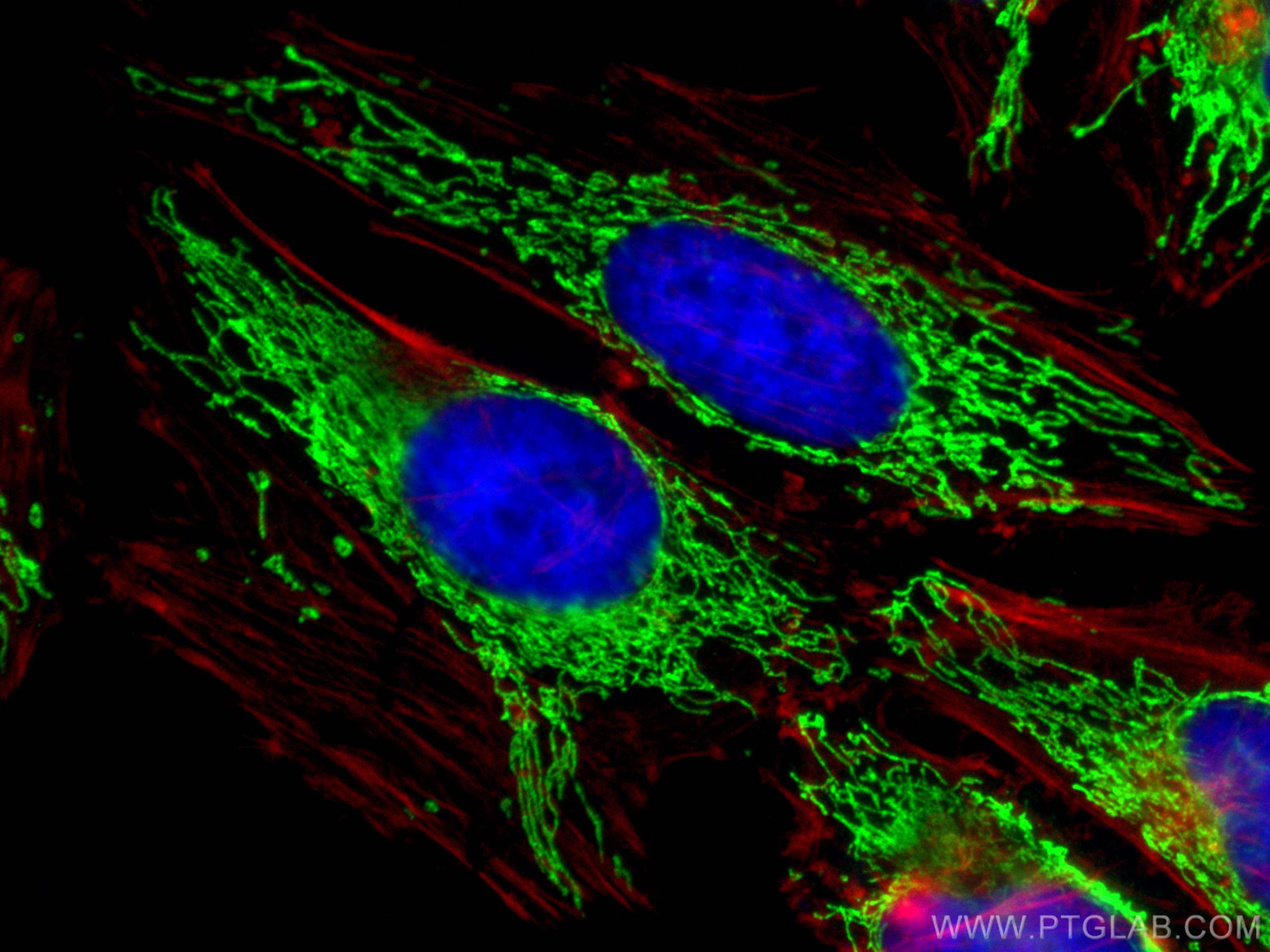 Immunofluorescence (IF) / fluorescent staining of HeLa cells using ECHS1 Recombinant antibody (81611-1-RR)