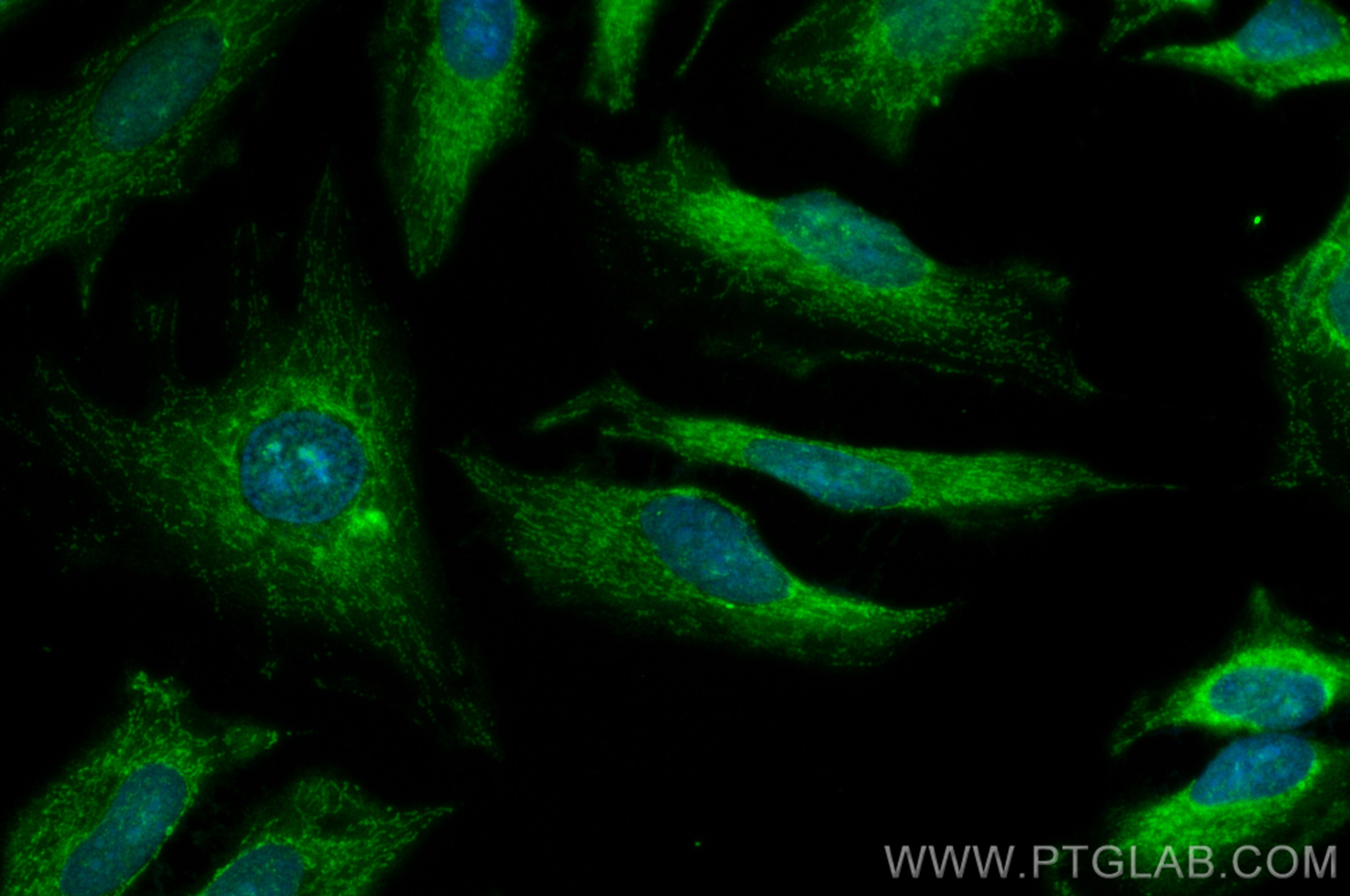 Immunofluorescence (IF) / fluorescent staining of HeLa cells using CoraLite® Plus 488-conjugated ECHS1 Polyclonal ant (CL488-11305)