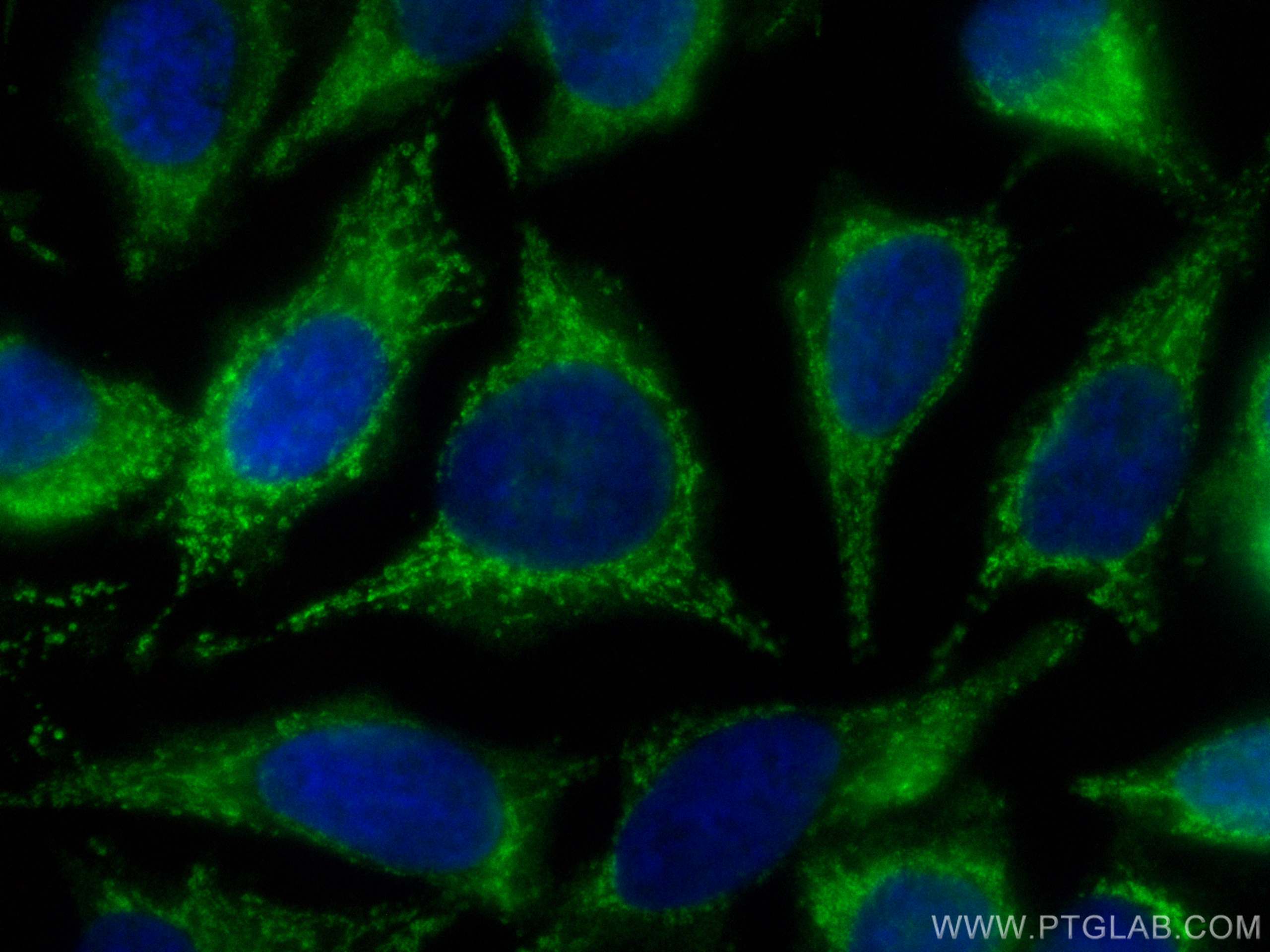 Immunofluorescence (IF) / fluorescent staining of HeLa cells using CoraLite® Plus 488-conjugated ECHS1 Polyclonal ant (CL488-11305)