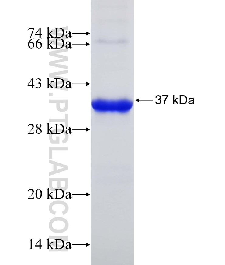 ECHS1 fusion protein Ag16775 SDS-PAGE