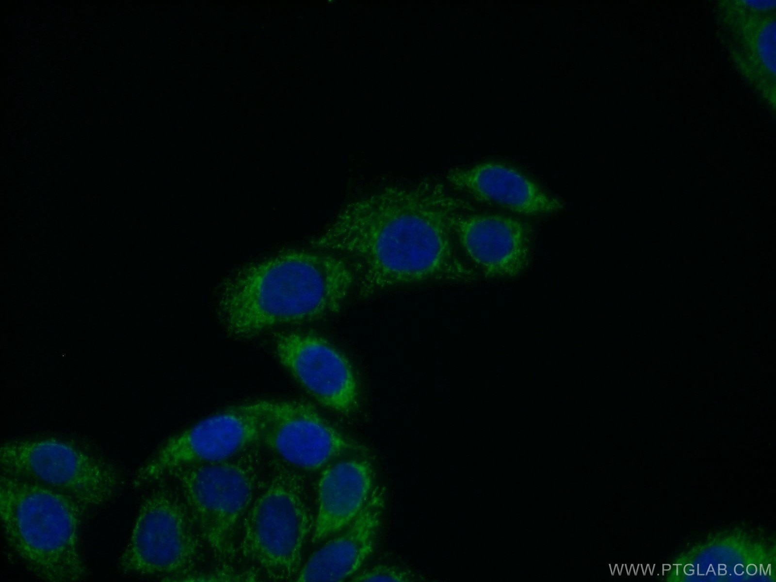 Immunofluorescence (IF) / fluorescent staining of HepG2 cells using ECM1 Polyclonal antibody (11521-1-AP)