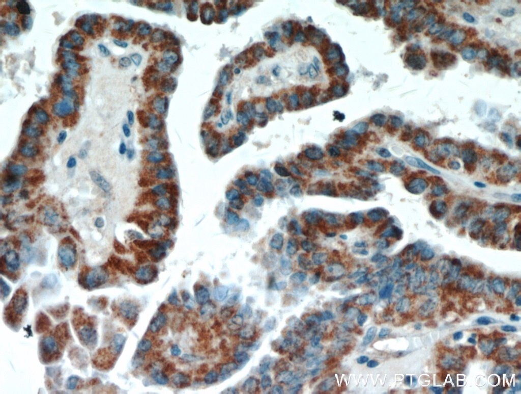 ECM1 Polyclonal antibody