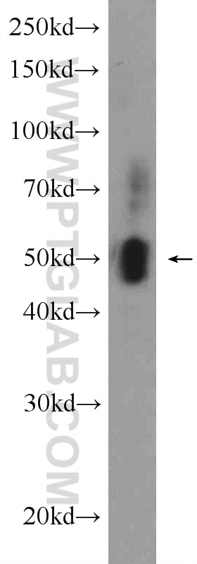 Western Blot (WB) analysis of rat pancreas tissue using ECM1 Polyclonal antibody (11521-1-AP)