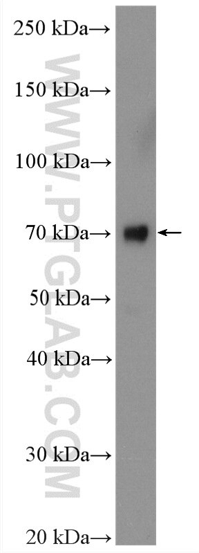 Western Blot (WB) analysis of A375 cells using ECM1 Polyclonal antibody (11521-1-AP)