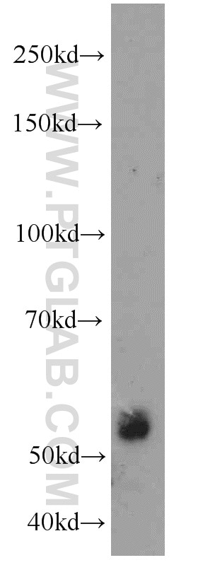 Western Blot (WB) analysis of A549 cells using ECM1 Polyclonal antibody (11521-1-AP)