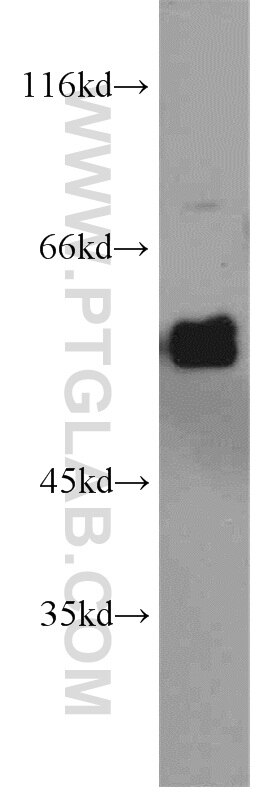Western Blot (WB) analysis of HepG2 cells using ECM1 Polyclonal antibody (11521-1-AP)