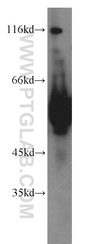 Western Blot (WB) analysis of mouse liver tissue using ECM1 Polyclonal antibody (11521-1-AP)