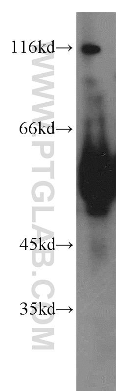 WB analysis of mouse liver using 11521-1-AP