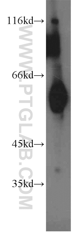 Western Blot (WB) analysis of mouse kidney tissue using ECM1 Polyclonal antibody (11521-1-AP)