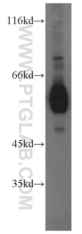 Western Blot (WB) analysis of MCF-7 cells using ECM1 Polyclonal antibody (11521-1-AP)