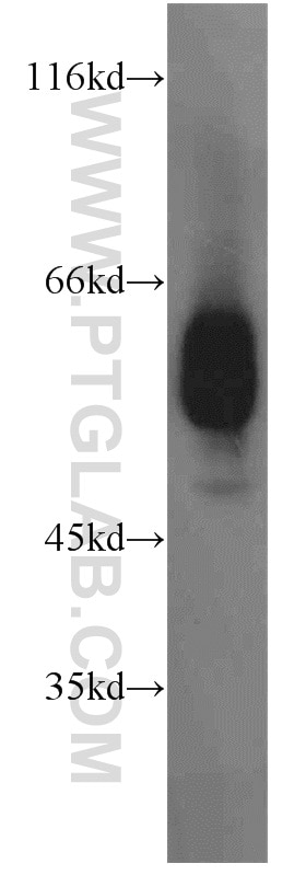 Western Blot (WB) analysis of mouse pancreas tissue using ECM1 Polyclonal antibody (11521-1-AP)