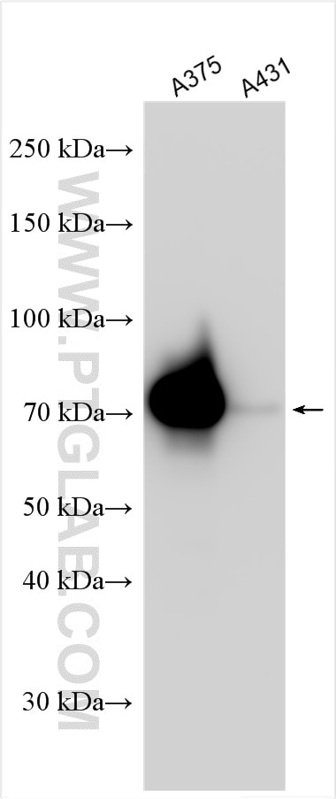 Western Blot (WB) analysis of various lysates using ECM1 Polyclonal antibody (30725-1-AP)