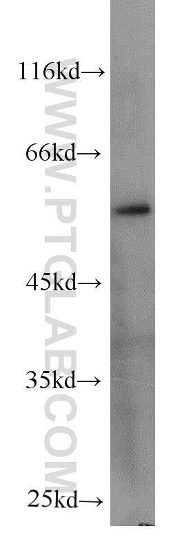 Western Blot (WB) analysis of human heart tissue using ECM1 Monoclonal antibody (66023-1-Ig)