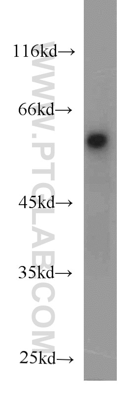 Western Blot (WB) analysis of COLO 320 cells using ECM1 Monoclonal antibody (66023-1-Ig)