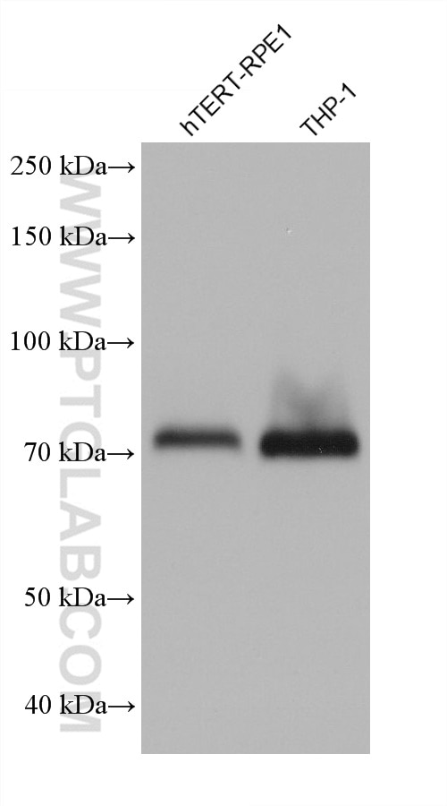 Western Blot (WB) analysis of various lysates using ECM1 Monoclonal antibody (68472-1-Ig)