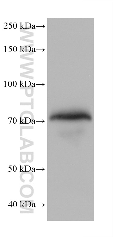 Western Blot (WB) analysis of human plasma using ECM1 Monoclonal antibody (68472-1-Ig)