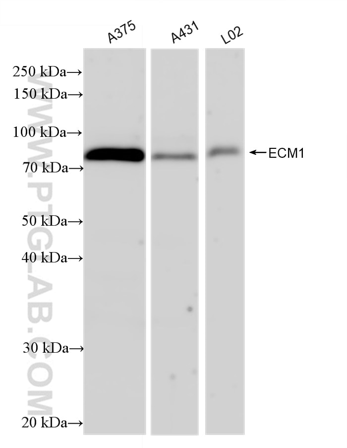 ECM1