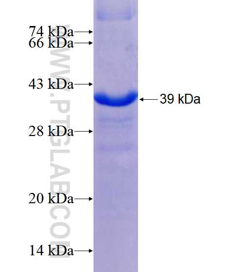 ECM1 fusion protein Ag17955 SDS-PAGE
