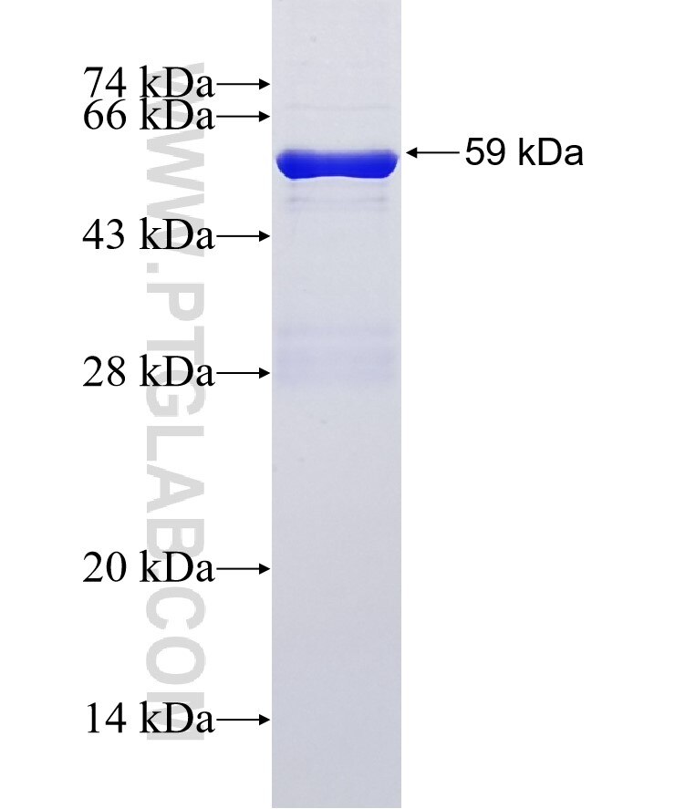 ECM1 fusion protein Ag2084 SDS-PAGE