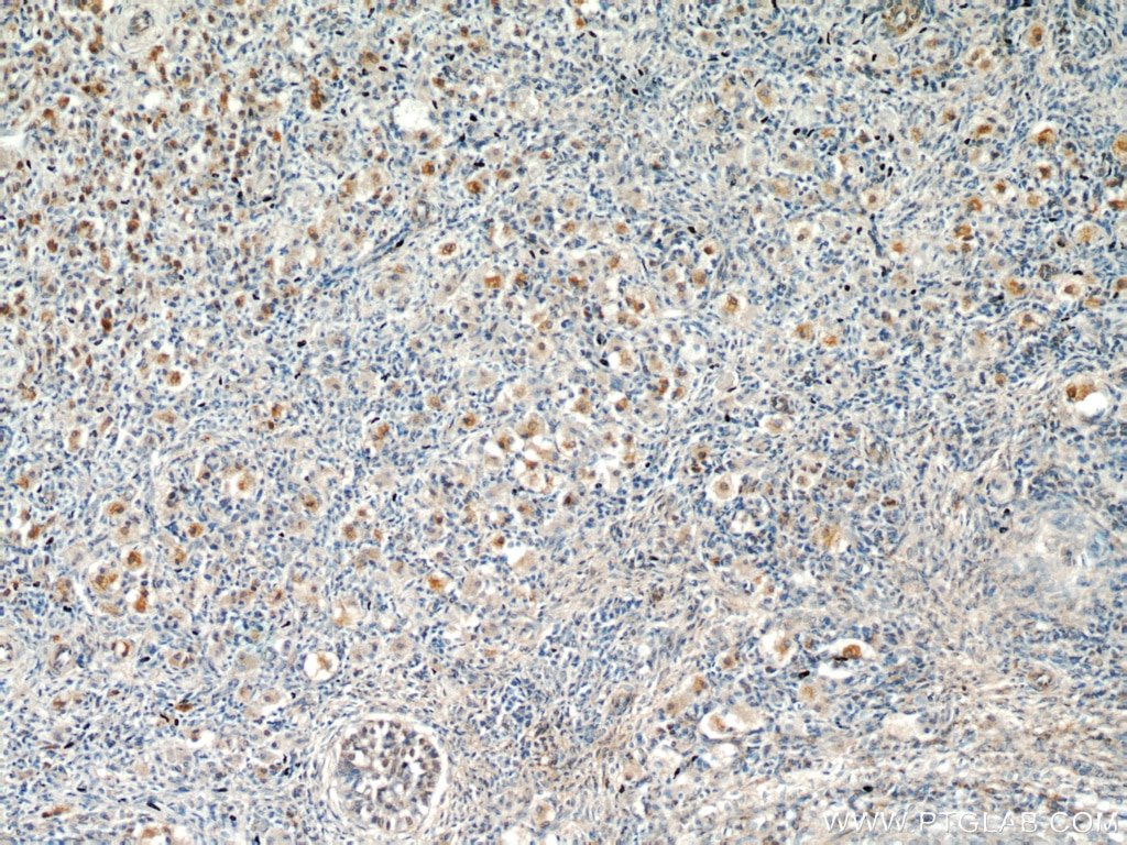 Immunohistochemistry (IHC) staining of human ovary tissue using ECM2 Polyclonal antibody (21376-1-AP)