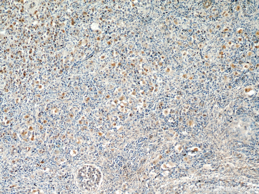 IHC staining of human ovary using 21376-1-AP