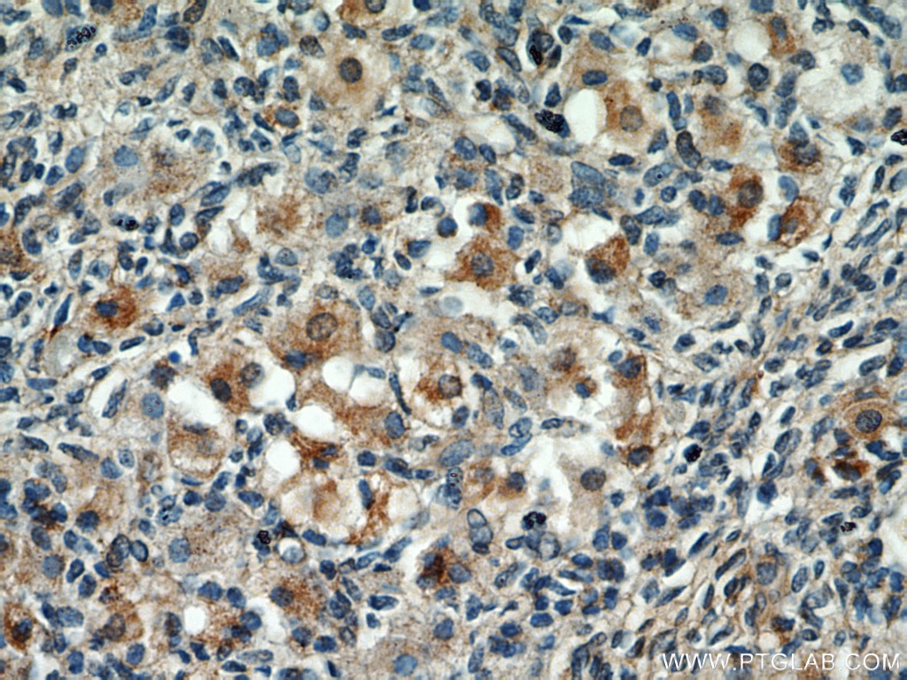 Immunohistochemistry (IHC) staining of human ovary tissue using ECM2 Polyclonal antibody (21376-1-AP)