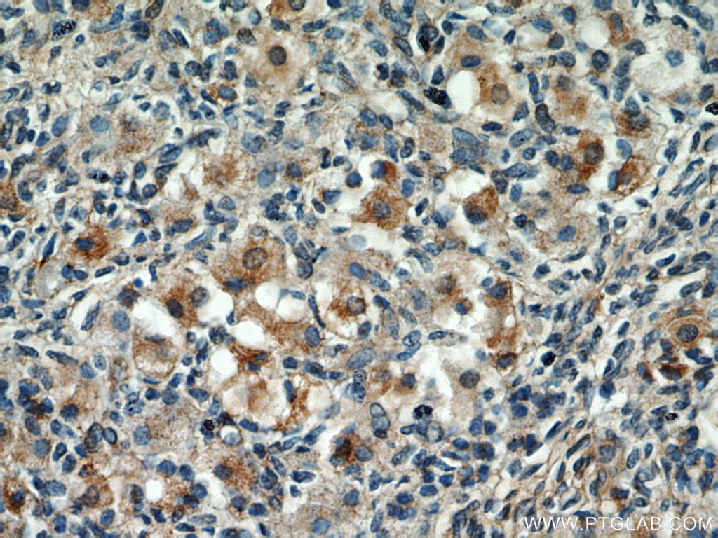 IHC staining of human ovary using 21376-1-AP