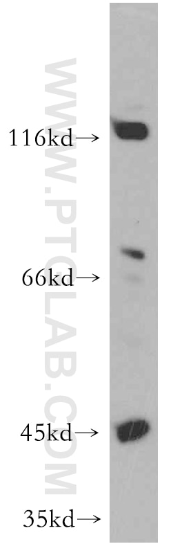 ECM2