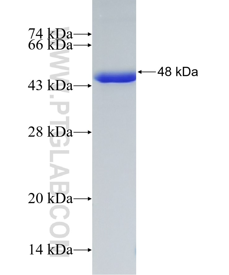ECM2 fusion protein Ag15913 SDS-PAGE