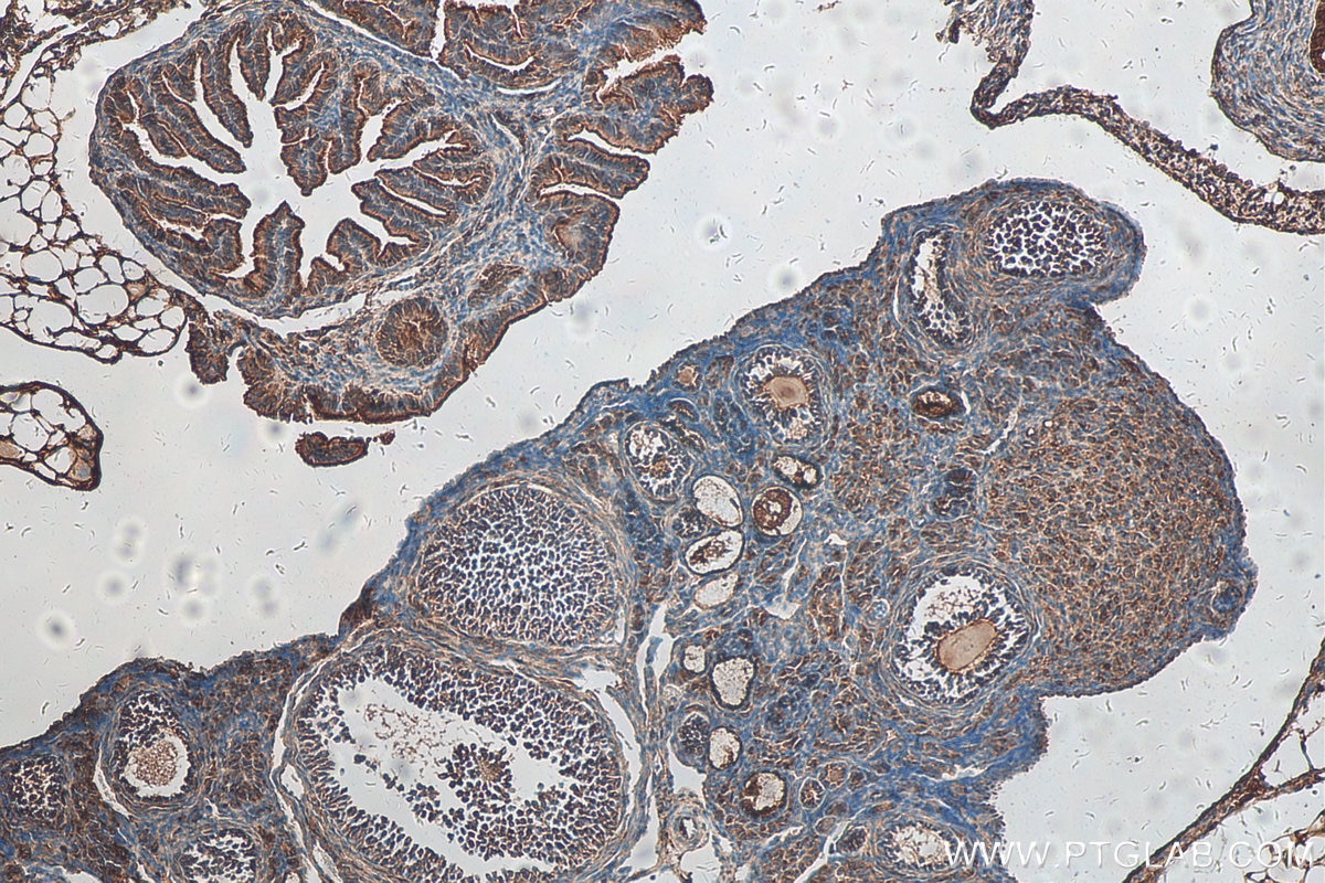Immunohistochemistry (IHC) staining of mouse ovary tissue using ECOP Polyclonal antibody (12611-1-AP)
