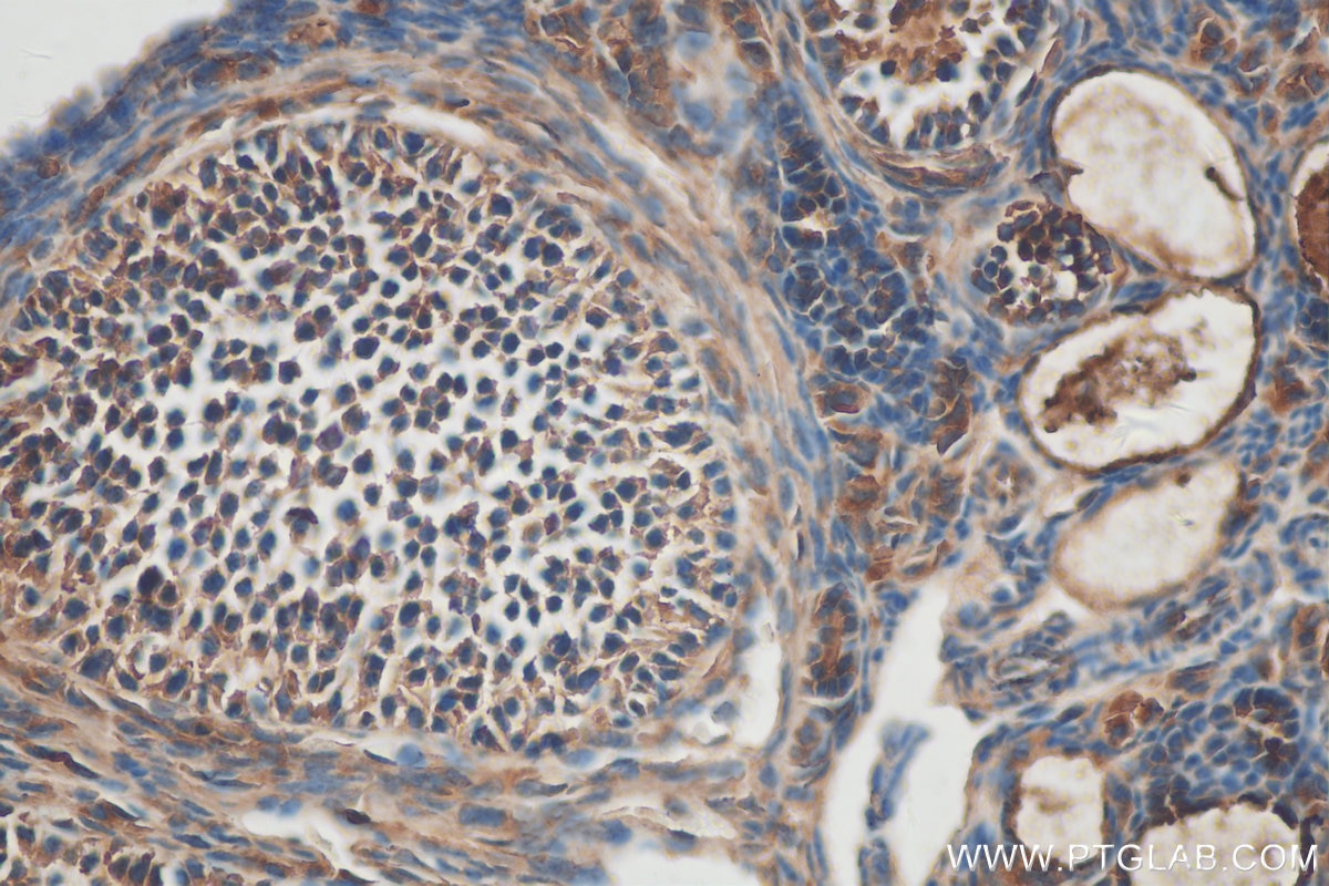 Immunohistochemistry (IHC) staining of mouse ovary tissue using ECOP Polyclonal antibody (12611-1-AP)