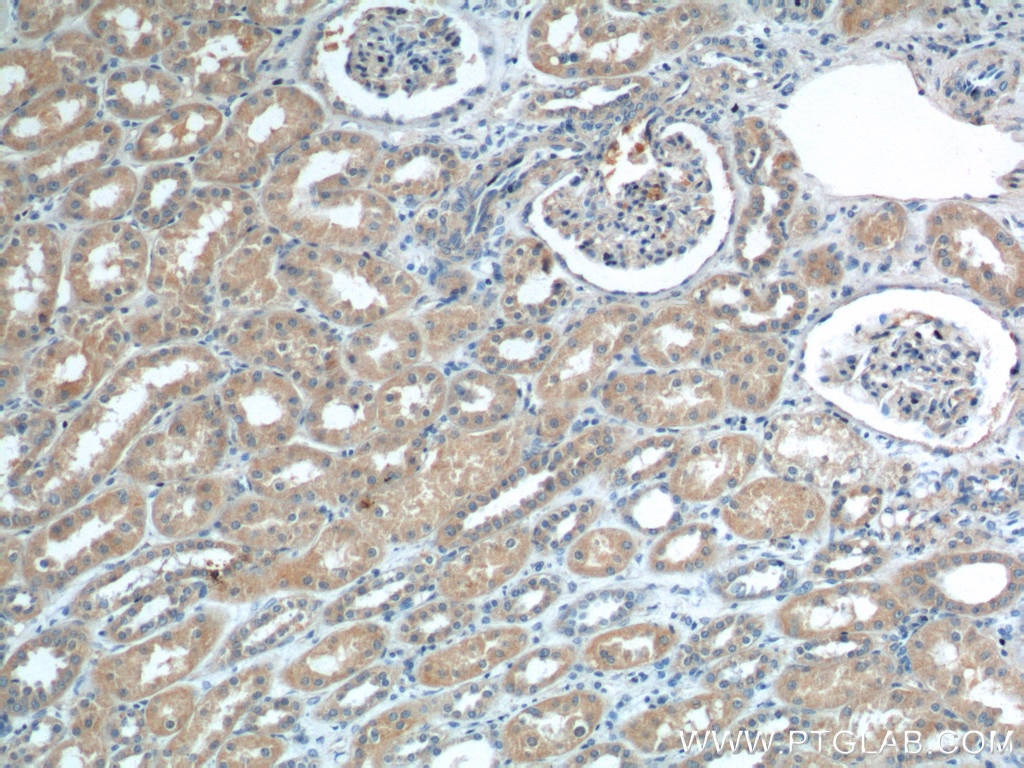 Immunohistochemistry (IHC) staining of human kidney tissue using ECOP Polyclonal antibody (12611-1-AP)
