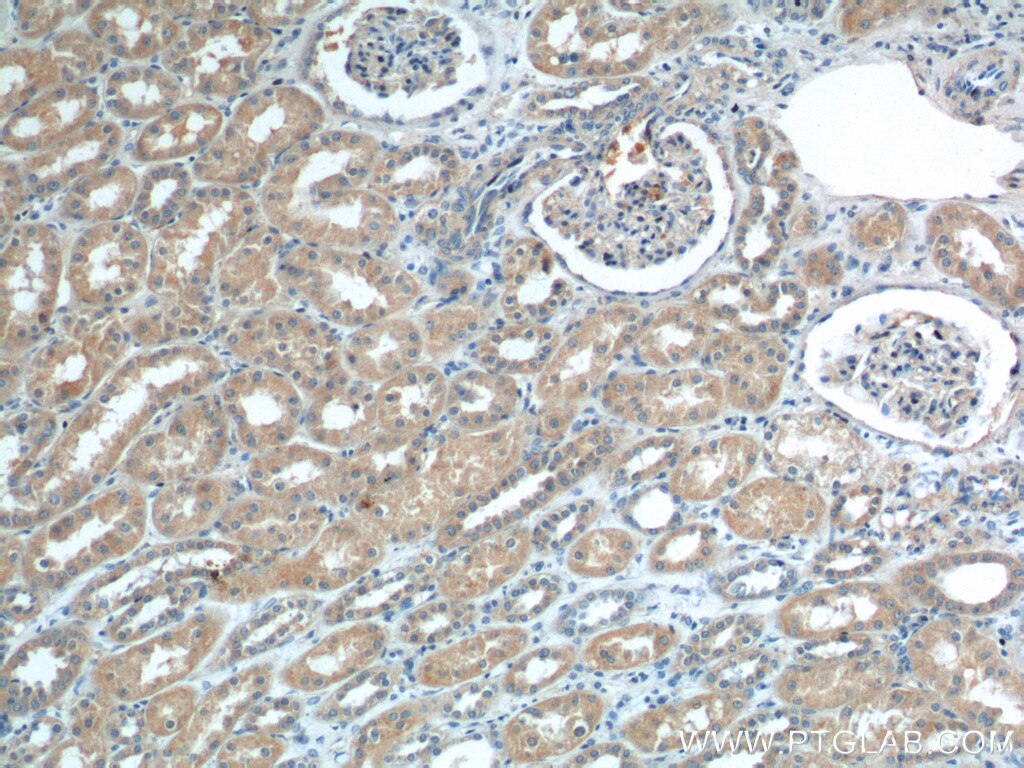 IHC staining of human kidney using 12611-1-AP