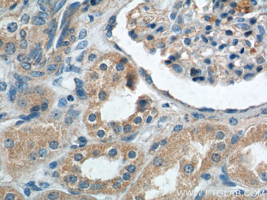 Immunohistochemistry (IHC) staining of human kidney tissue using ECOP Polyclonal antibody (12611-1-AP)