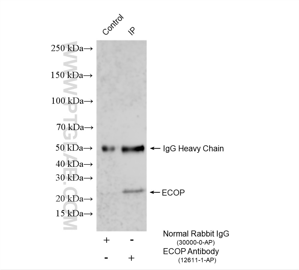 Immunoprecipitation (IP) experiment of A549 cells using ECOP Polyclonal antibody (12611-1-AP)
