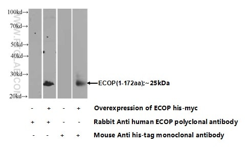 Western Blot (WB) analysis of Transfected HEK-293 cells using ECOP Polyclonal antibody (12611-1-AP)