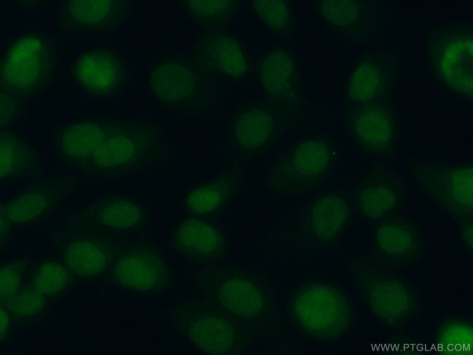 Immunofluorescence (IF) / fluorescent staining of A431 cells using DPPA2 Polyclonal antibody (12689-1-AP)