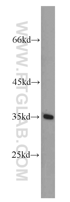 Western Blot (WB) analysis of MCF-7 cells using DPPA2 Polyclonal antibody (12689-1-AP)