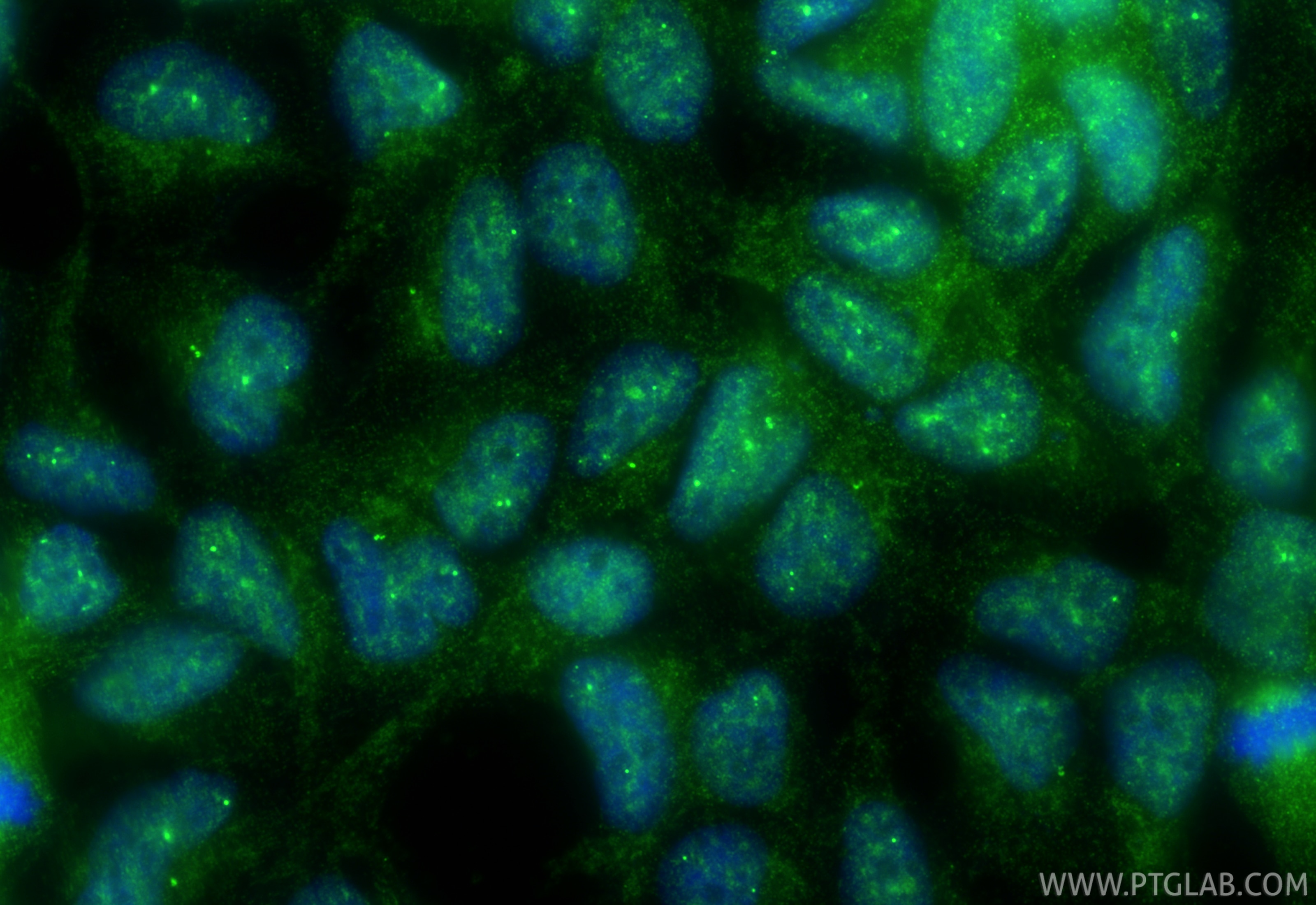 IF Staining of HEK-293 using RMX00048 Immunofluorescence (IF) / fluorescent staining of HEK-293 cells using Multi-rAb® ECSIT Multi-Recombinant antibody (RMX00048)