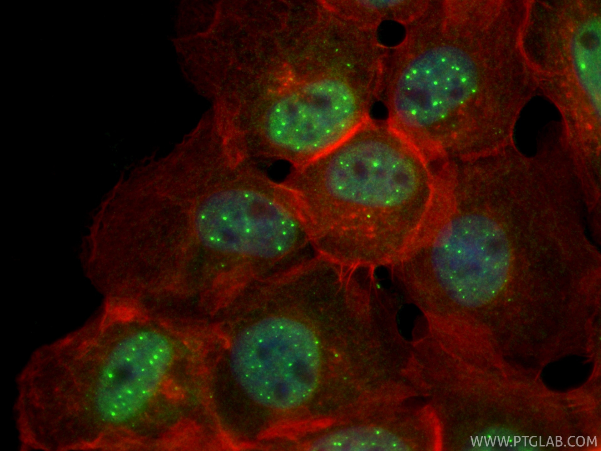 IF Staining of A431 using RMX00048 Immunofluorescence (IF) / fluorescent staining of A431 cells using Multi-rAb® ECSIT Multi-Recombinant antibody (RMX00048)