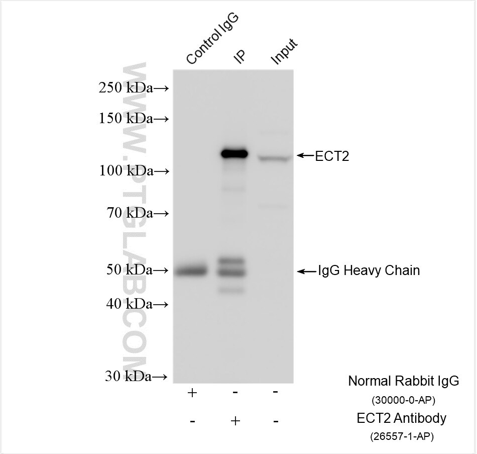 Immunoprecipitation (IP) experiment of K-562 cells using ECT2 Polyclonal antibody (26557-1-AP)