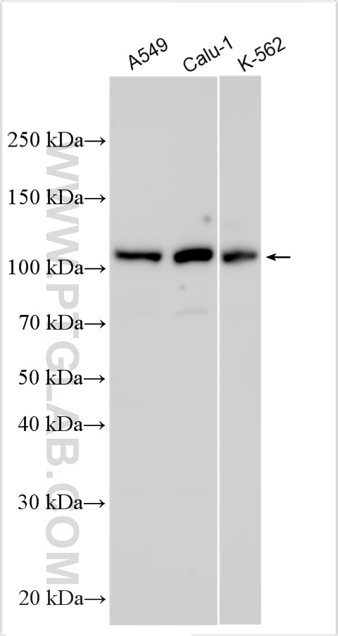Western Blot (WB) analysis of various lysates using ECT2 Polyclonal antibody (26557-1-AP)